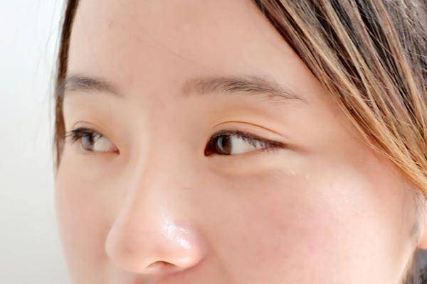 女子戴蒸汽眼罩睡觉视力受损敲响警钟正确使用方法你get了吗？(图2)