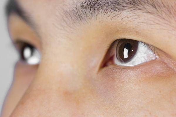 女子戴蒸汽眼罩睡觉视力受损敲响警钟正确使用方法你get了吗？(图3)